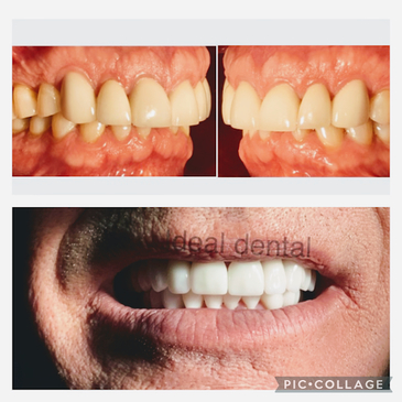 Slider image (7) Ideal Dental Mexico City